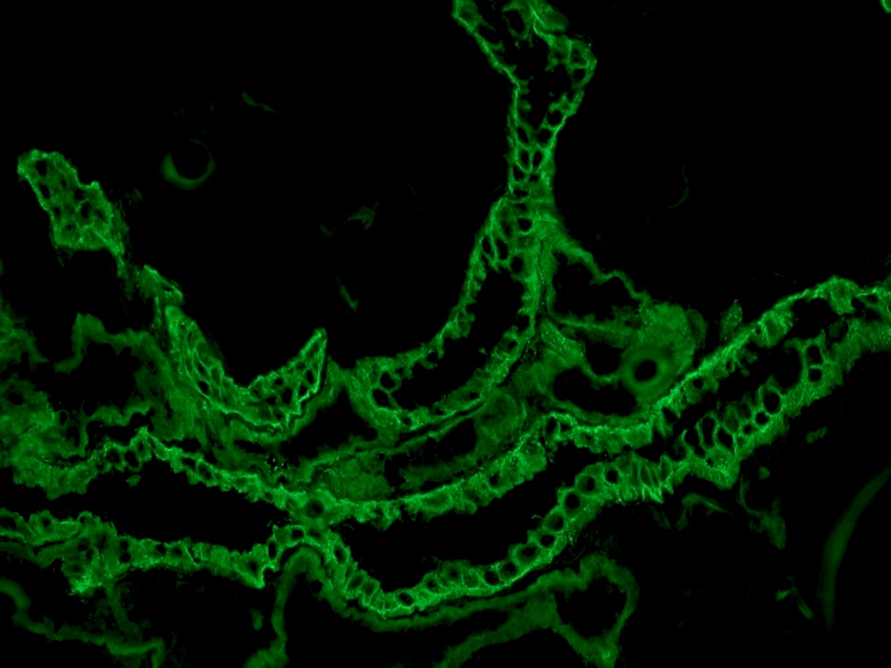 Figure 1. Indirect immunofluorescence staining of EpCam in human kidney epithelial cells using MUB2061P, clone HEA125 at a 1:500 dilution.